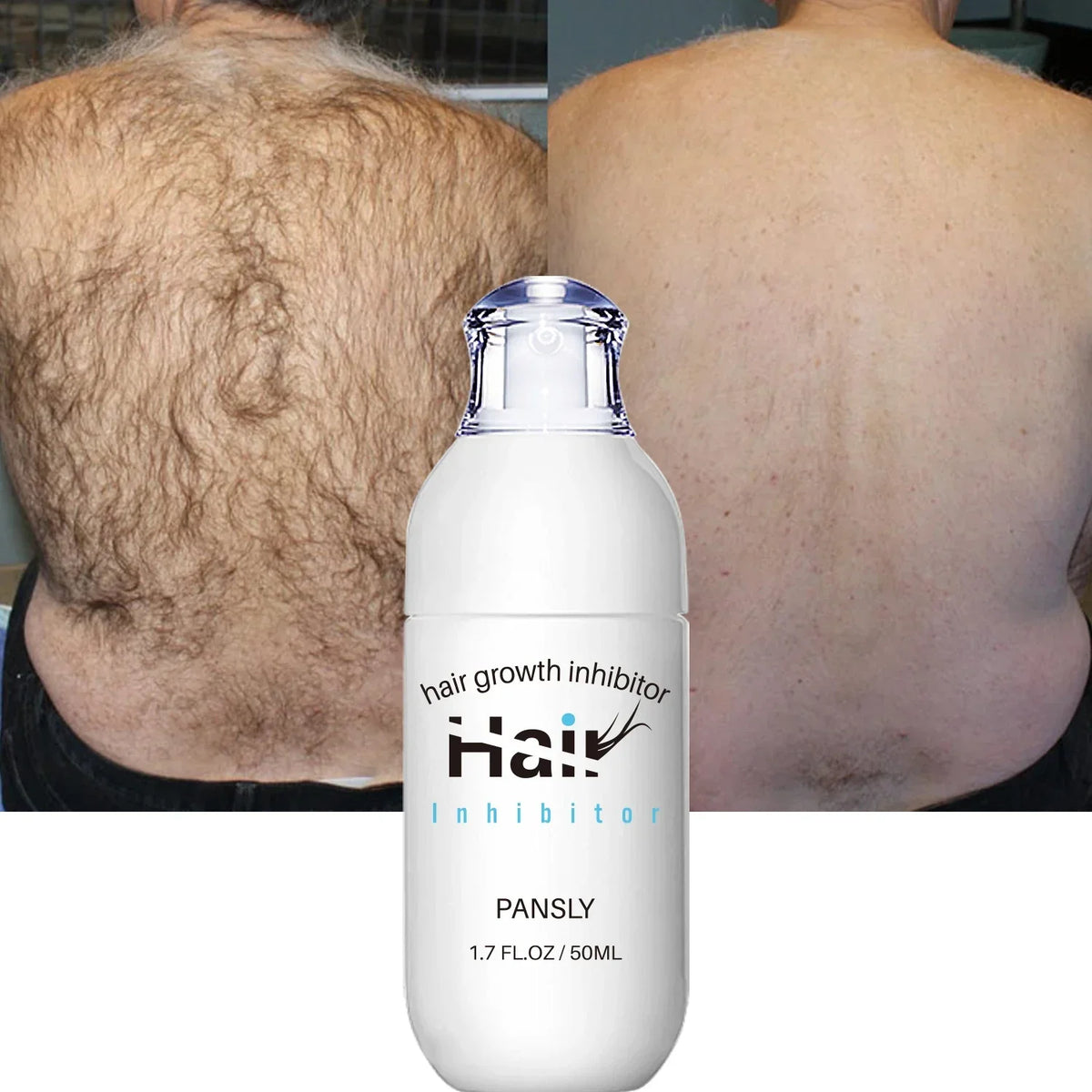 Hair Removal Spray Hair Growth Inhibitor Spray Painless Hair Reduction Permanently Inhibits Hair Growth Skin Silky Smooth 100ML