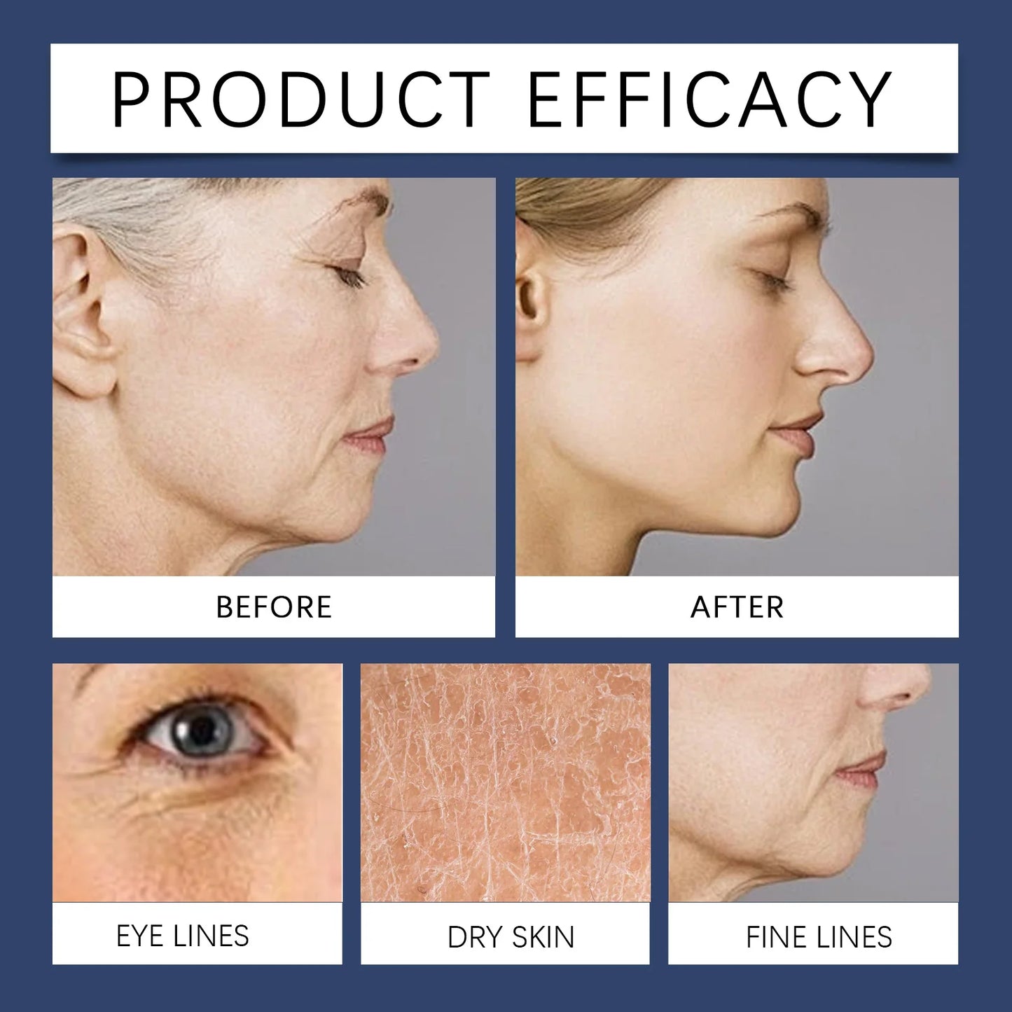 HOYGI Polypeptide Firming Cream Instant Anti Wrinkle Lasting Moisturizing Fading Fine Lines Lifting Revitalizing Face Skin Care