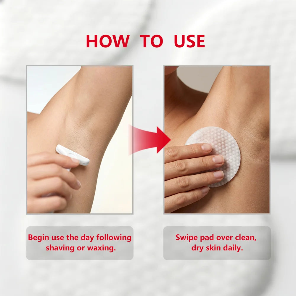 Aftershave Treatment Pads Ingrown Hair Pads to Help Prevent Razor Bumps for Men & Women - Exfoliate Underarms & Bikini Area